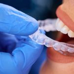 How Invisalign Aligner Changes Affect Your Dietary Habits and Nutritional Timing Throughout Treatment