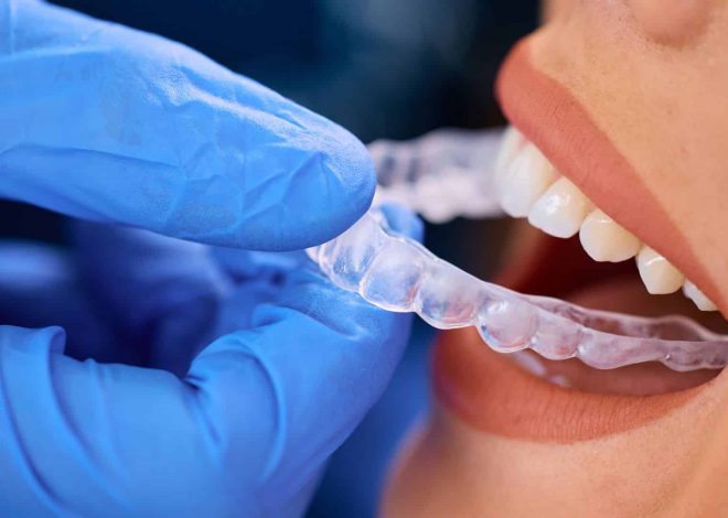 How Invisalign Aligner Changes Affect Your Dietary Habits and Nutritional Timing Throughout Treatment